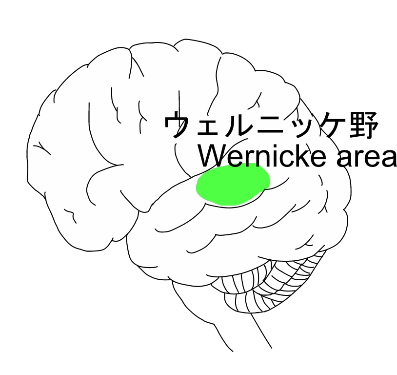 ウェルニッケ野